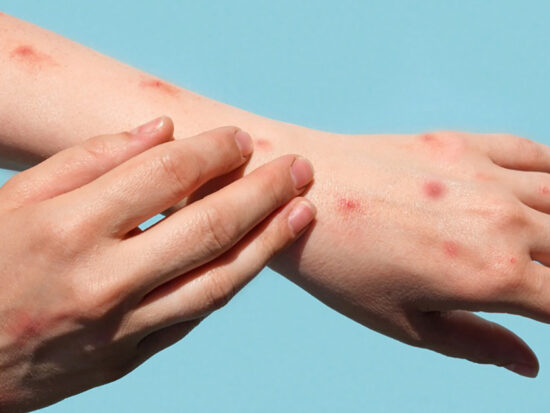 sarampión Juárez El Paso