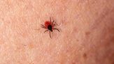 rickettsiosis